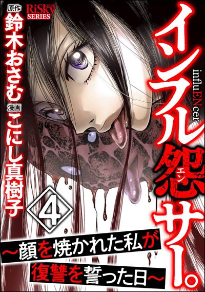 インフル怨サー。 ～顔を焼かれた私が復讐を誓った日～ （4）